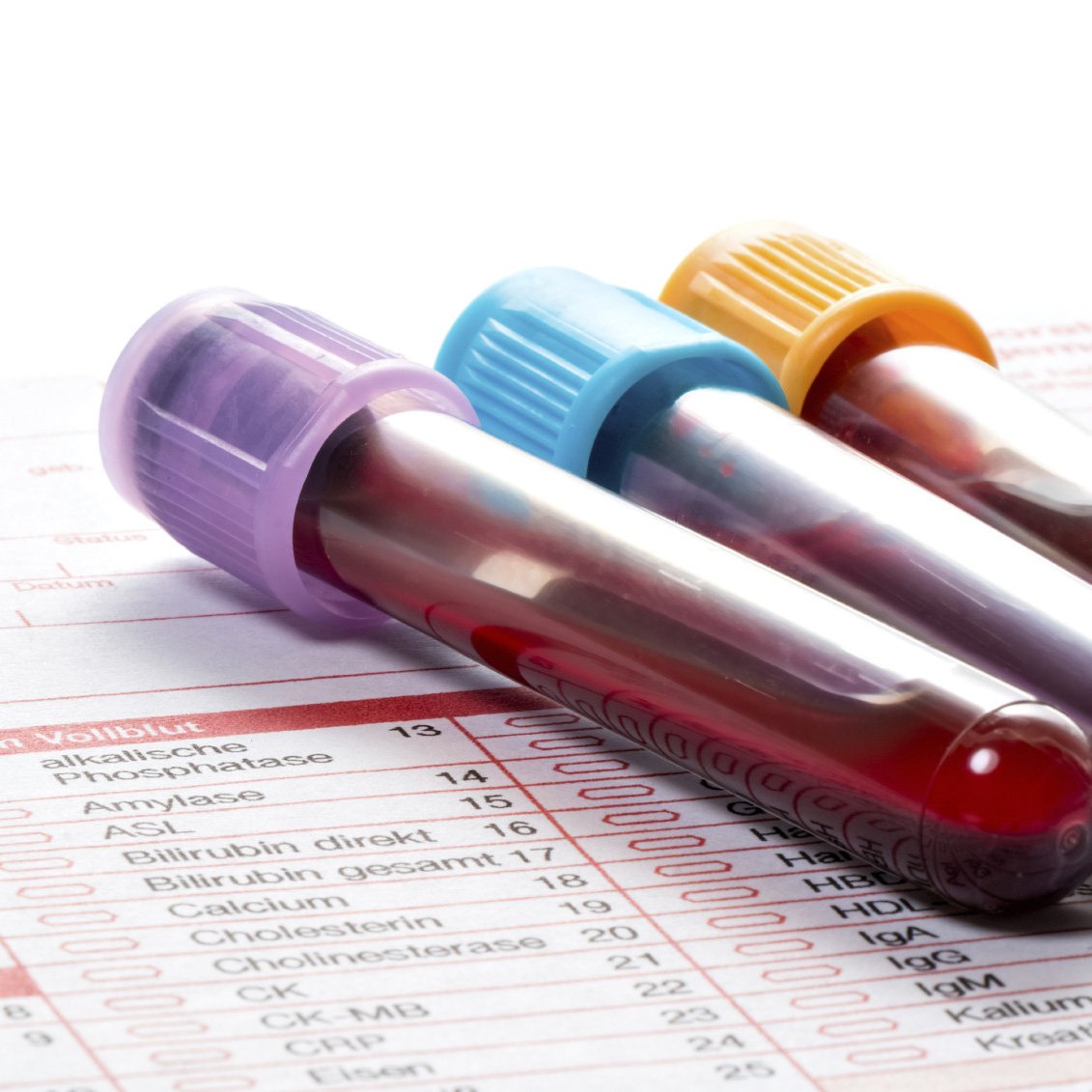 Blood tests